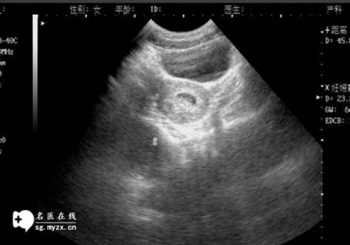 新生儿凝血五项标准，揭秘宝宝的健康状况