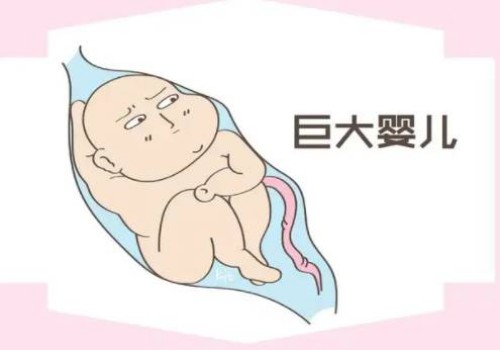 一文解读什么是单柳叶形子宫，一种常见的子宫畸形